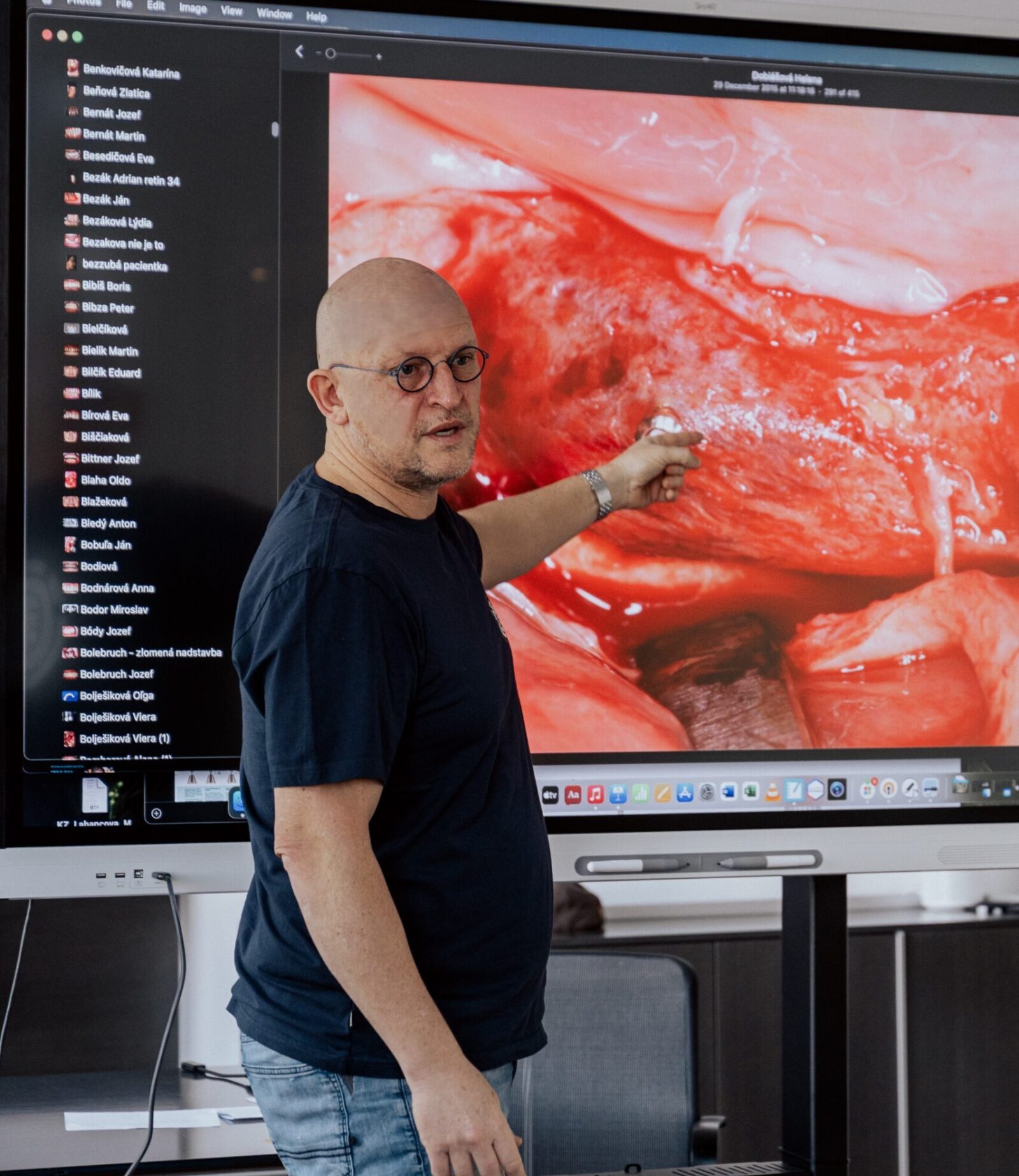 Modul A - Od základov implantológie po komplexné rekonštrukcie